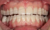 Клиника биоэстетической стоматологии доктора Даяна фотография 7