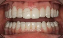 Клиника биоэстетической стоматологии доктора Даяна фотография 5