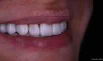 Клиника эстетической стоматологии Dr.Blumkin фотография 14