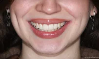Клиника эстетической стоматологии Dr.Blumkin фотография 17