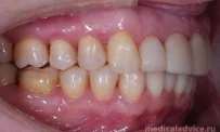 Клиника стоматологии и ортодонтии Нувахова Н.Р. фотография 6