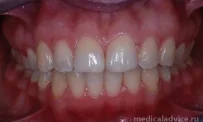 Клиника стоматологии и ортодонтии Нувахова Н.Р. фотография 5