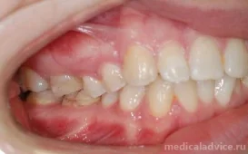 Клиника стоматологии и ортодонтии Нувахова Н.Р. фотография 3