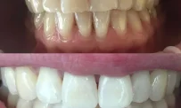 Стоматологическая клиника Natura smile dental clinic фотография 6