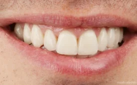 Клиника семейной профилактической стоматологии Белая Радуга на Котельнической набережной фотография 3