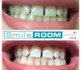 Студия отбеливания зубов Smile Room на Цветном бульваре фотография 2