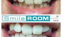 Студия отбеливания зубов Smile Room на Цветном бульваре фотография 4