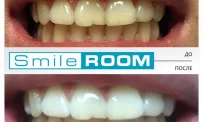 Студия отбеливания зубов Smile Room на Цветном бульваре фотография 6