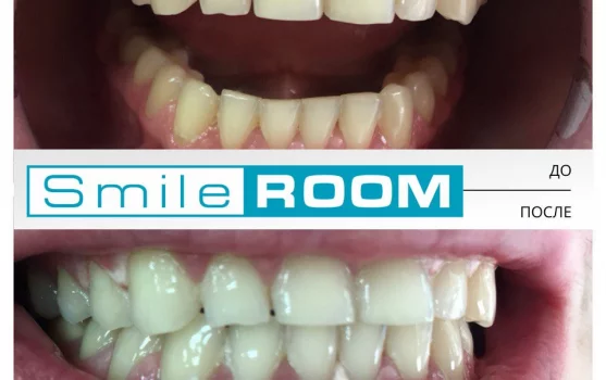 Студия отбеливания зубов Smile Room на Цветном бульваре фотография 1