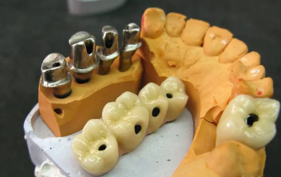 Зуботехническая лаборатория Продео Дентал Технолоджи фотография 1