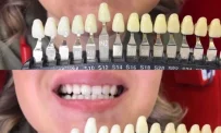 Студия отбеливания зубов White&Smile фотография 8