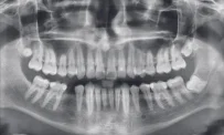 Центр диагностики челюстно-лицевой области Пикассо на проспекте Андропова фотография 7
