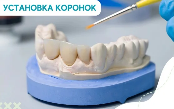 Стоматология Зубы в порядке фотография 1