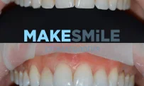 Стоматологическая клиника MakeSmile фотография 6