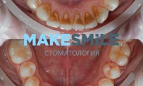 Стоматологическая клиника MakeSmile фотография 7