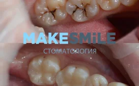 Стоматологическая клиника MakeSmile фотография 3