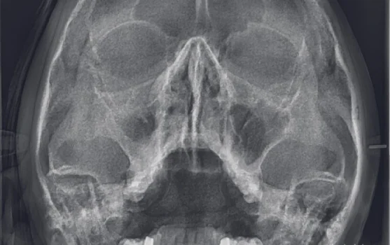 Центр рентгенодиагностики Пикассо на Семёновской площади фотография 1