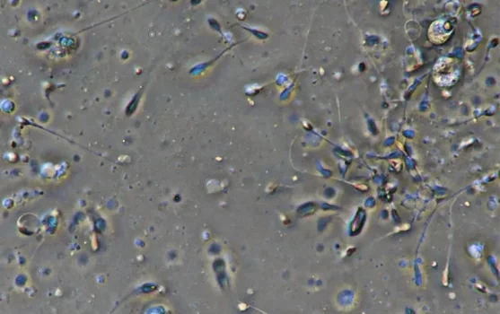 Лаборатория спермиологии Сперма-тест фотография 1