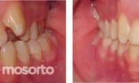 Стоматологическая клиника Mosorto фотография 6