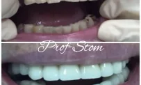 Клиника профессиональной стоматологии фотография 4