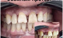 Авторская стоматология Громовой фотография 9