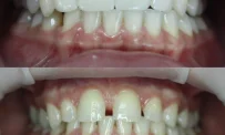 Авторская стоматология Громовой фотография 6