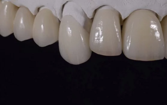 Зуботехническая лаборатория OralConcept фотография 1