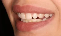 Стоматология Доктора Хачатуряна Best Smile Clinic фотография 4