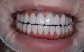 Стоматология Доктора Хачатуряна Best Smile Clinic фотография 3