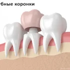 Протезное отделение Балашихинская стоматологическая поликлиника №1 на Парковой улице фотография 2
