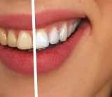 Студия косметического отбеливания зубов Вайт Смайл Плюс 