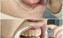 Стоматологическая клиника Happydent24.ru фотография 6