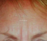 Косметология Чистая кожа фотография 2