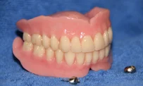 Зуботехническая лаборатория Классика фотография 4