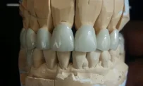 Зуботехническая лаборатория Классика фотография 5