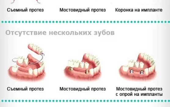 Клиника стоматологии Аквастом фотография 1