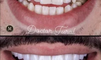 Стоматологическая клиника Мусаева Турала фотография 16