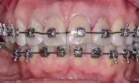 Стоматологическая клиника Dental Clinic фотография 4