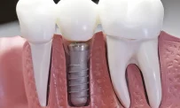 Стоматологическая клиника Правильная стоматология фотография 4