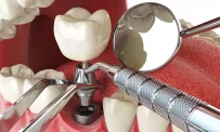 Клиника современной стоматологии Dental фотография 6