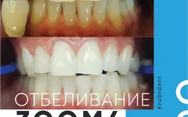 Клиника стоматологии Зубр фотография 3