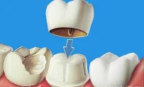 Стоматологическая клиника Ф-стоматология фотография 8