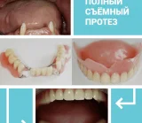 Лазерная стоматология на Рубцовской набережной фотография 2