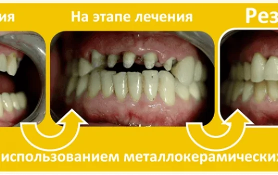 Лазерная стоматология на Рубцовской набережной фотография 1
